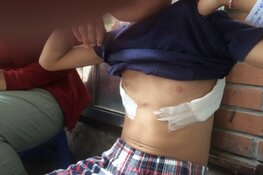 Child Surgery Vietnam maakt een einde aan operatie achterstanden bij kinderen